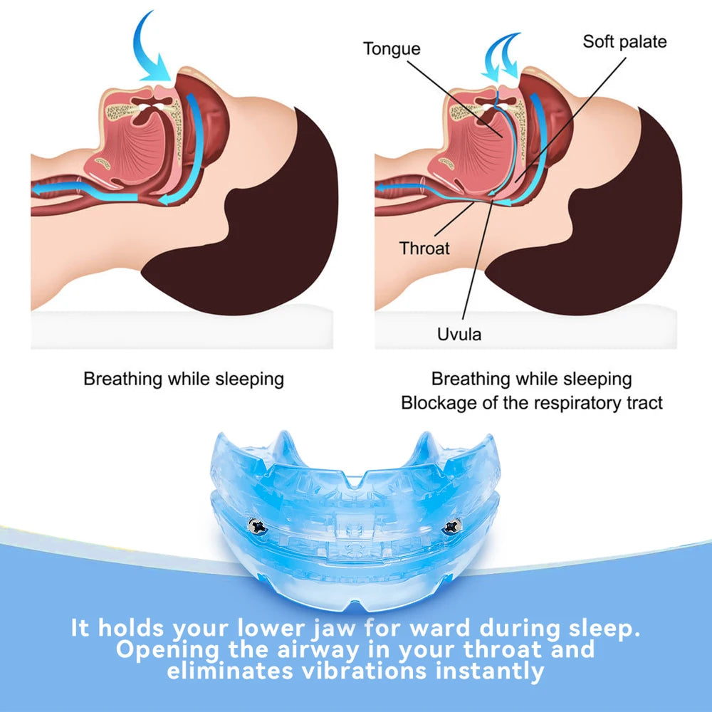 Deep in Health™ Adjustable Anti Snoring Mouth Guard